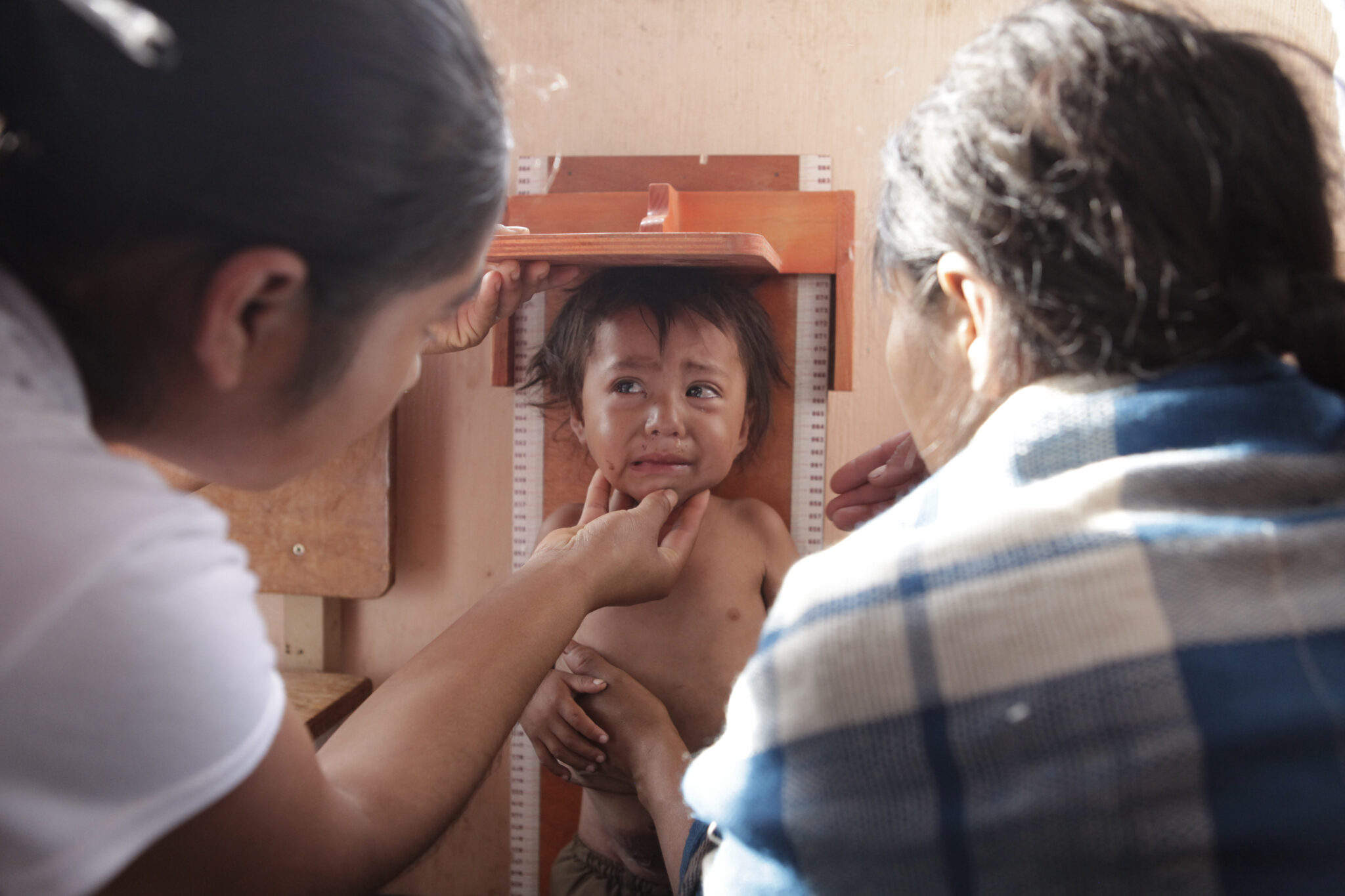 Niña con desnutrición es medida en Guatemala. Foto: Edwin Bercián