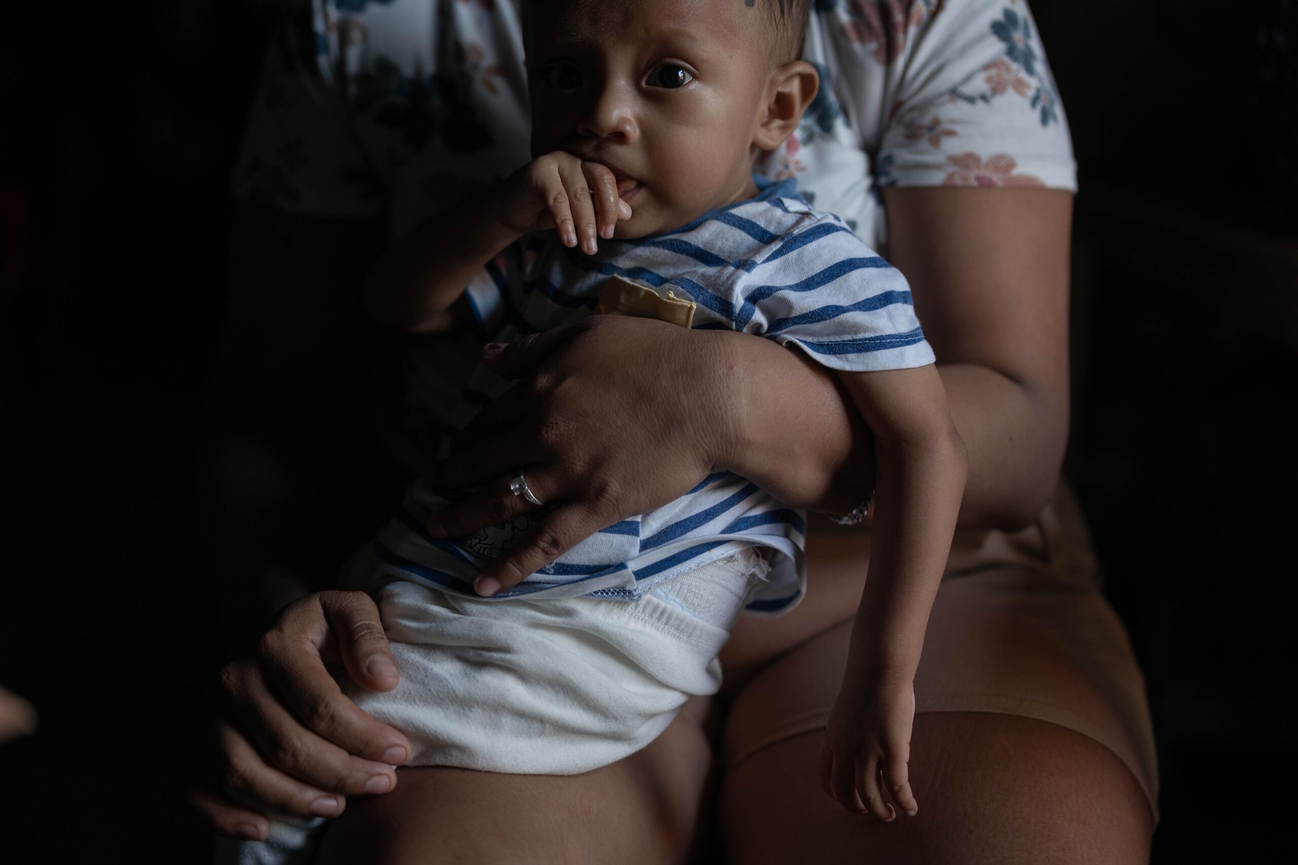 Retrato de Ian Cabrera Vicente, a los diez meses de edad luego de haber enfermado de cálculos renales, su peso era de 13 libras.